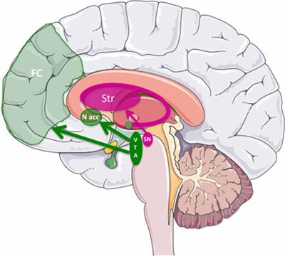 Combining Gene Transfer and Nonhuman Primates to Better Understand and Treat Parkinson’s Disease